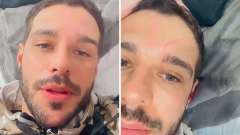 Rodrigo Mussi comove ao mostrar cicatriz após acidente: 