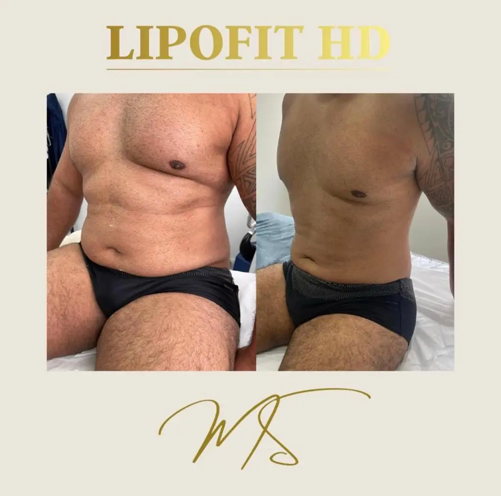 O Renomado Empresário Havi Yossef, Trás Nova Proposta Na Área De Saúde Estética 5 Whatsapp Image 2022 10 03 At 17.36.40 4 Egobrazil