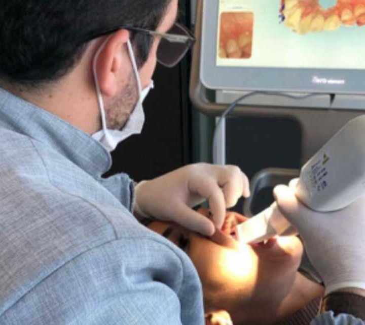 Dr. Leonardo Brasil - Invisalign em Recife - Clareamento Dental