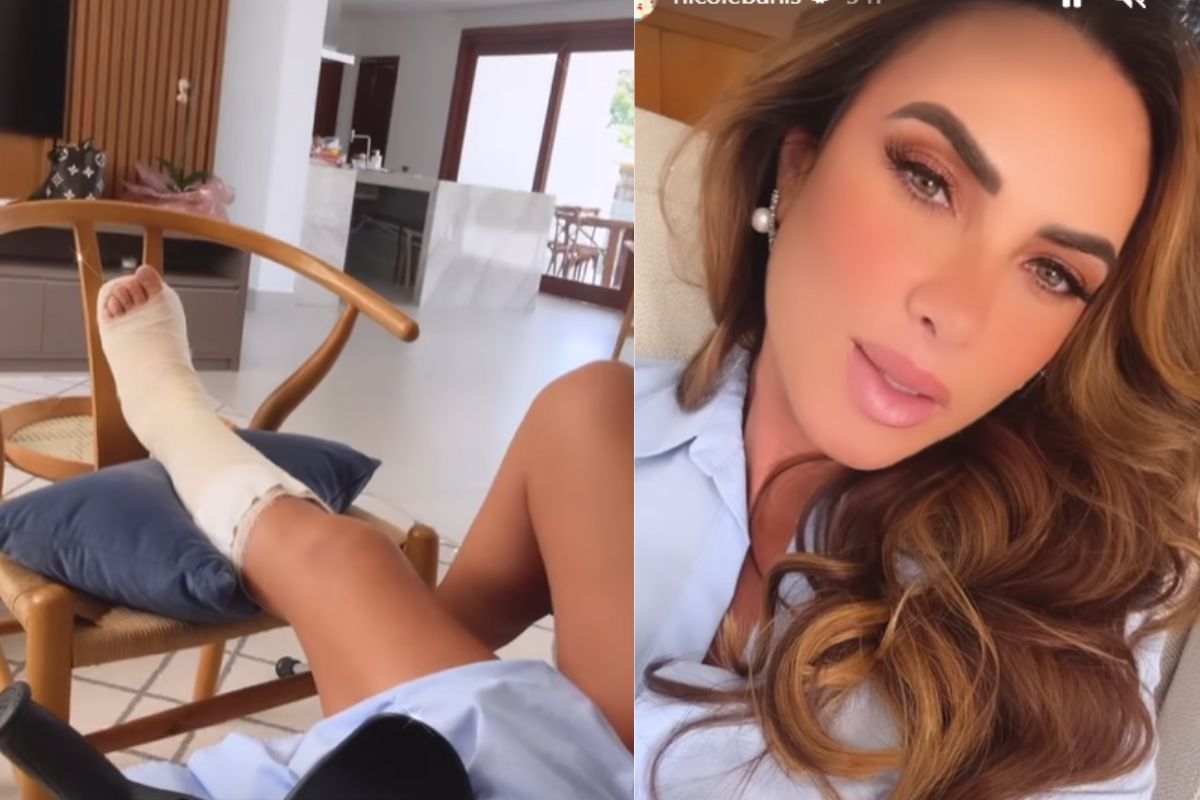 Nicole Bahls faz cirurgia após se machucar no Navio da Xuxa
