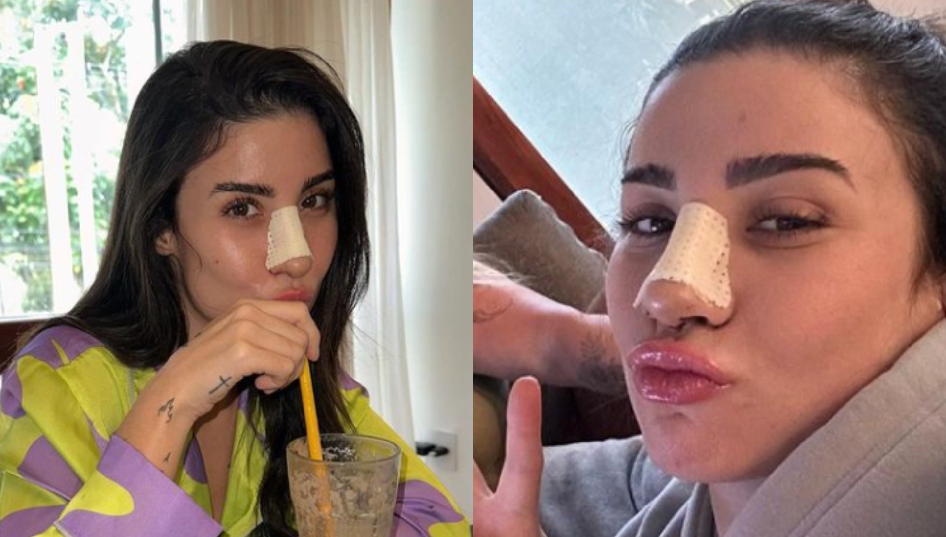 Bianca Andrade surge com curativo no nariz após refazer cirurgia: ‘Dores’