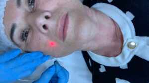 Clínica Bella Mooca: Um Marco de Inovação em Estética Avançada em São Paulo