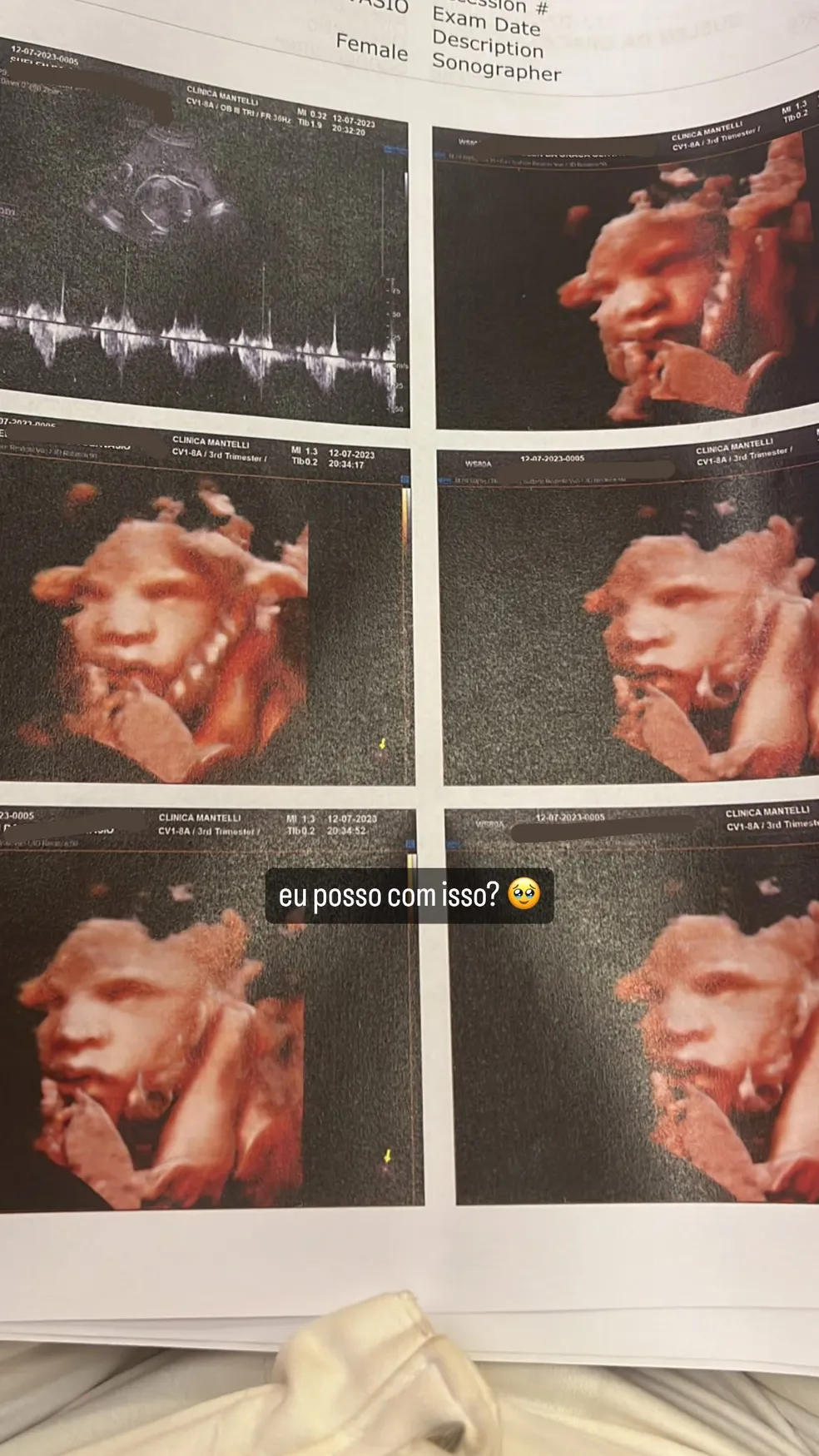 Grávida de Vitão, Suelen Gervasio mostra rostinho da filha em ultrassom — Foto: Instagram