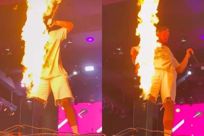 Que perigo! Zé Felipe tem rosto atingido por chamas durante show