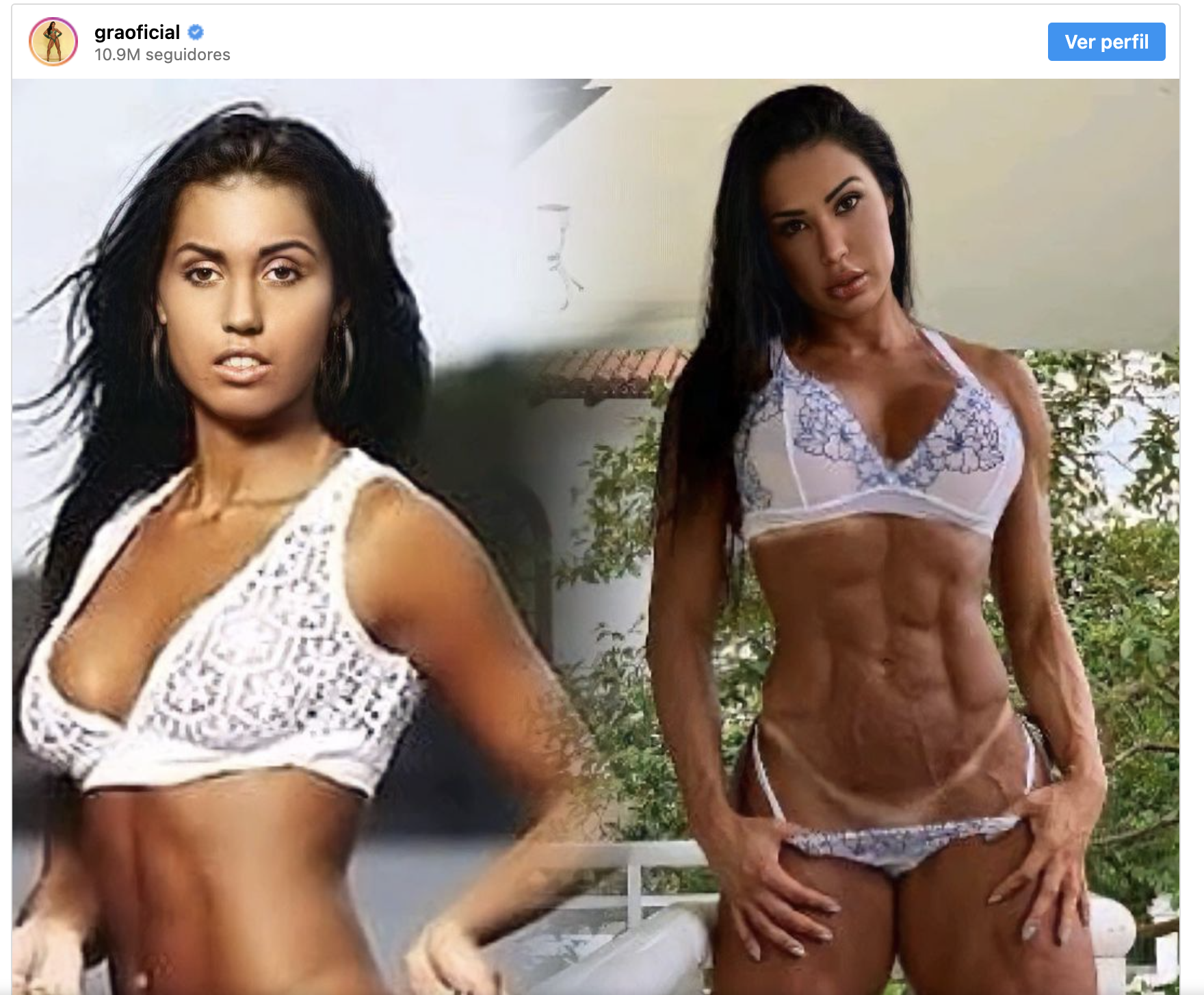 Gracyanne Barbosa surpreende ao postar "antes e depois" nas redes