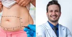 Cirurgias Plásticas combinadas é seguro? Dr. Sérgio Cruz revela receio dos pacientes
