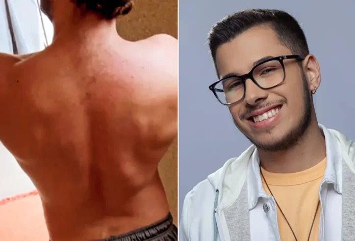 João Gustavo, irmão de Marília Mendonça, mostra antes e depois do corpo — Foto: Reprodução/Instagram