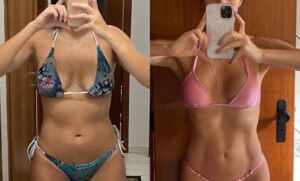 Os cuidados na gravidez pós-Lipo HD: Desafios de Virginia Fonseca