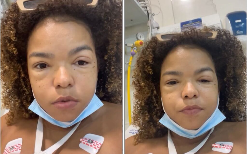 Jeniffer Nascimento mostra rosto após hospitalização por reação alérgica