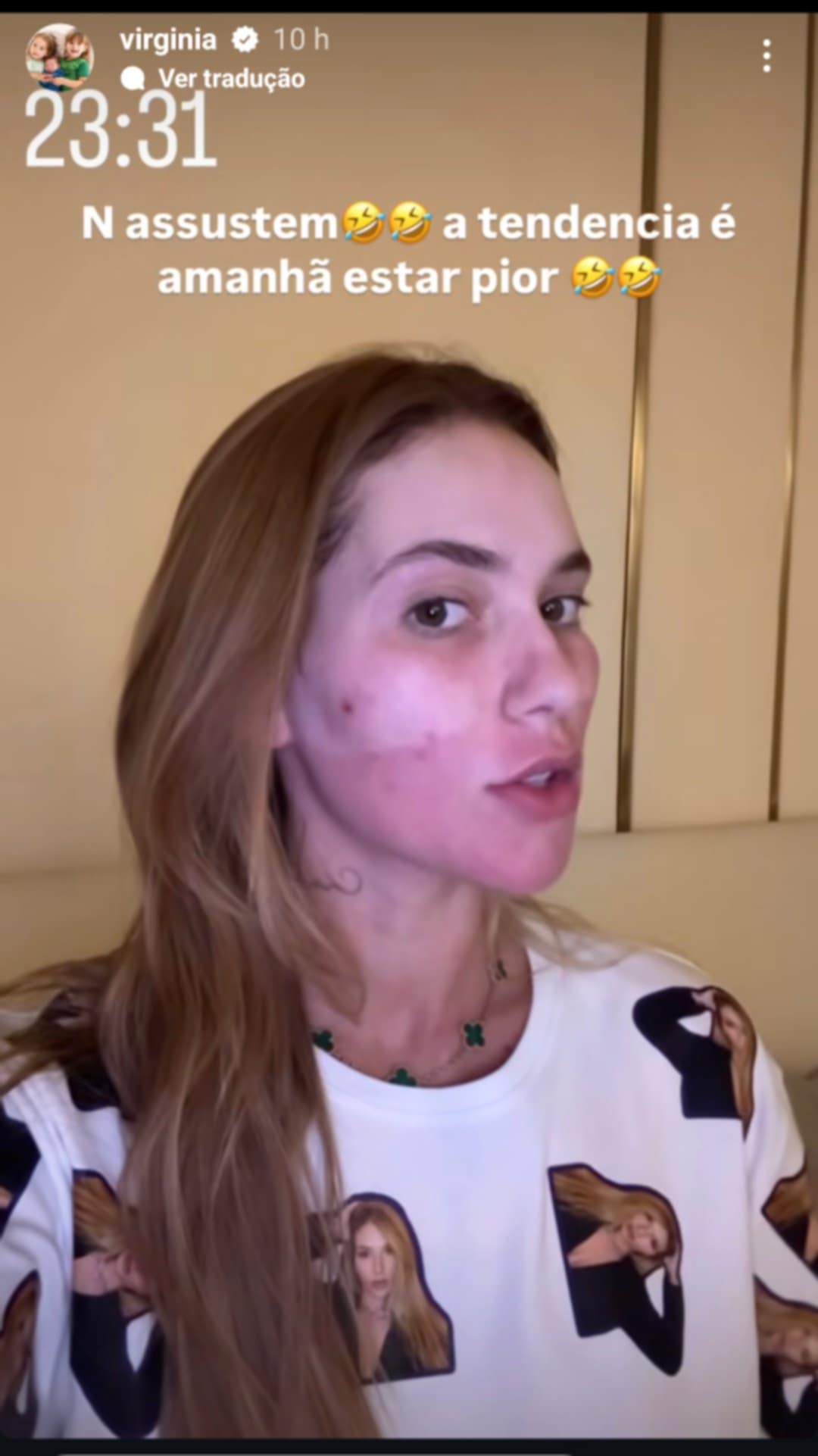 Virginia Fonseca surpreende Maria Flor após procedimento facial - Foto: Instagram