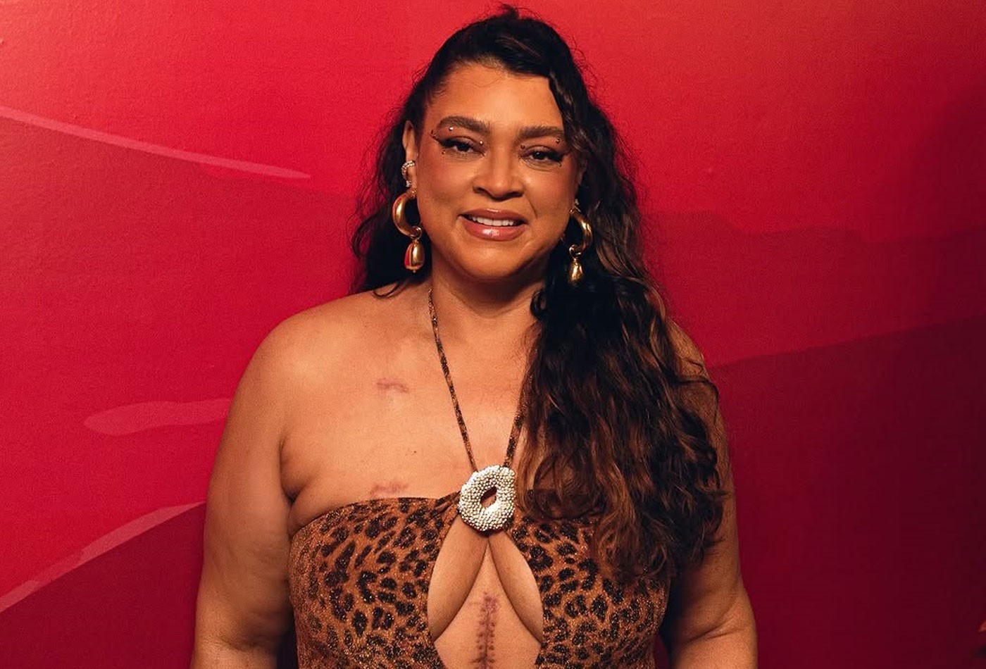 Preta Gil Recebe Alta Após 14 Dias Internada 2 Preta Gil
