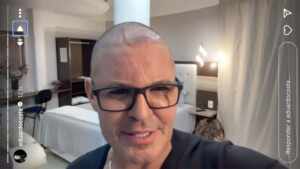 Eduardo Costa surpreende ao surgir careca em show e desabafa nas redes sobre novo visual