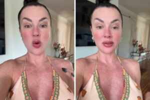 Juju Salimeni revela diagnóstico de dengue e mostra manchas pelo corpo