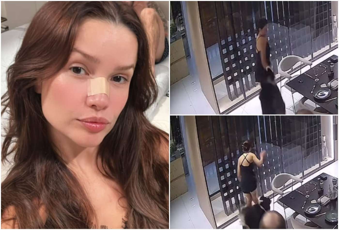 Juliette Quase Sofre Novo Acidente Doméstico Após Fraturar O Nariz 2 Juliette