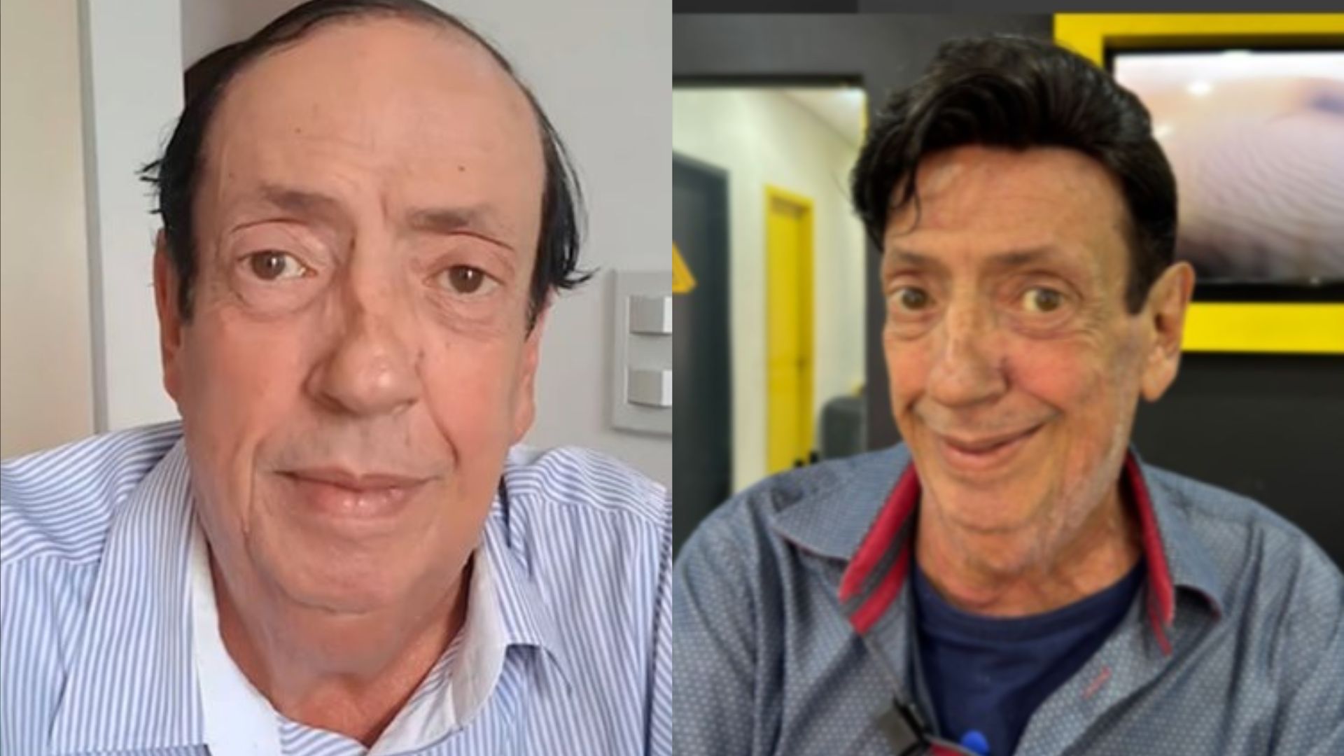 Marcos Oliveira Exibe Novo Visual Após Colocar Prótese Capilar 2 Marcos Oliveira - Foto: Internet