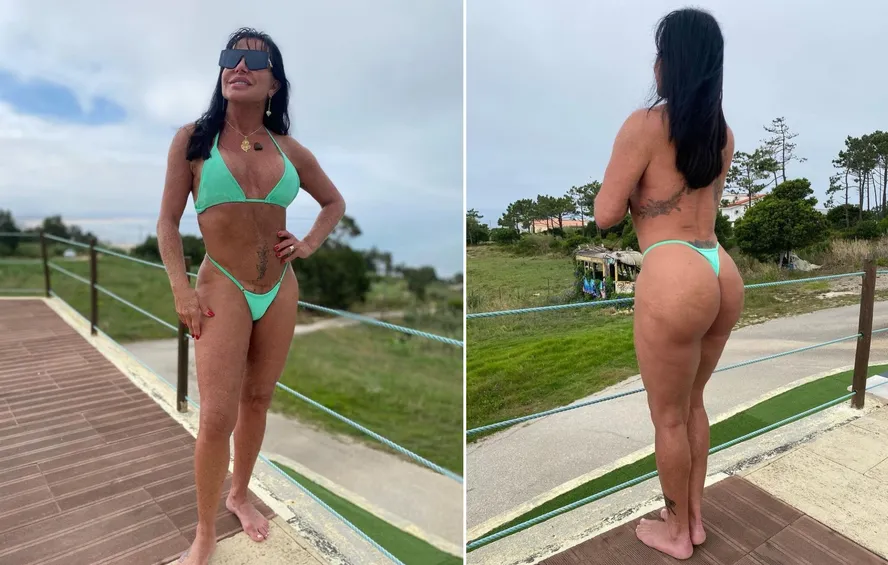 Gretchen Exibe Nova Fase E Revela Procedimento Estético Após Deixar Reality Show 2 Gretchen Exibe Nova Fase E Revela Procedimento Estético Após Deixar Reality Show