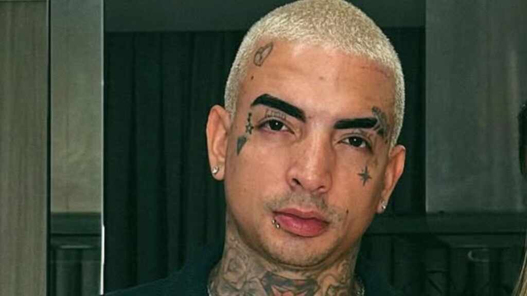 Mc Guimê Surpreende Ao Mostrar O Resultado Da Harmonização Facial; Veja!