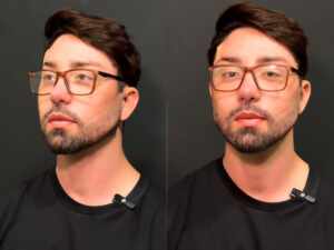 Rico Melquiades é barrado na imigração em Dubai após procedimentos estéticos