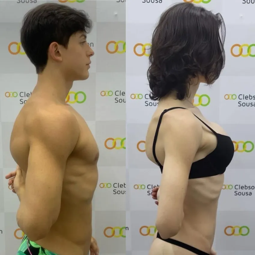 Isabella Longuinho compartilha antes e depois de sua transição de gênero - Foto: instagram