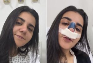 Após término com Maria Venture, Yasmin Santos faz rinoplastia e explica motivo do procedimento