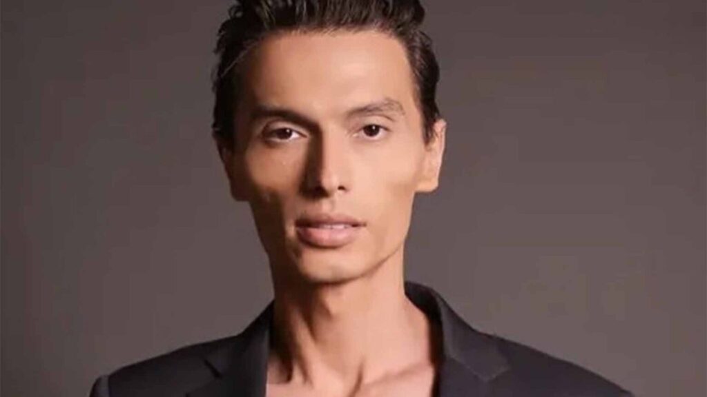 Ex-marido de Mara Maravilha surge muito magro em novas fotos