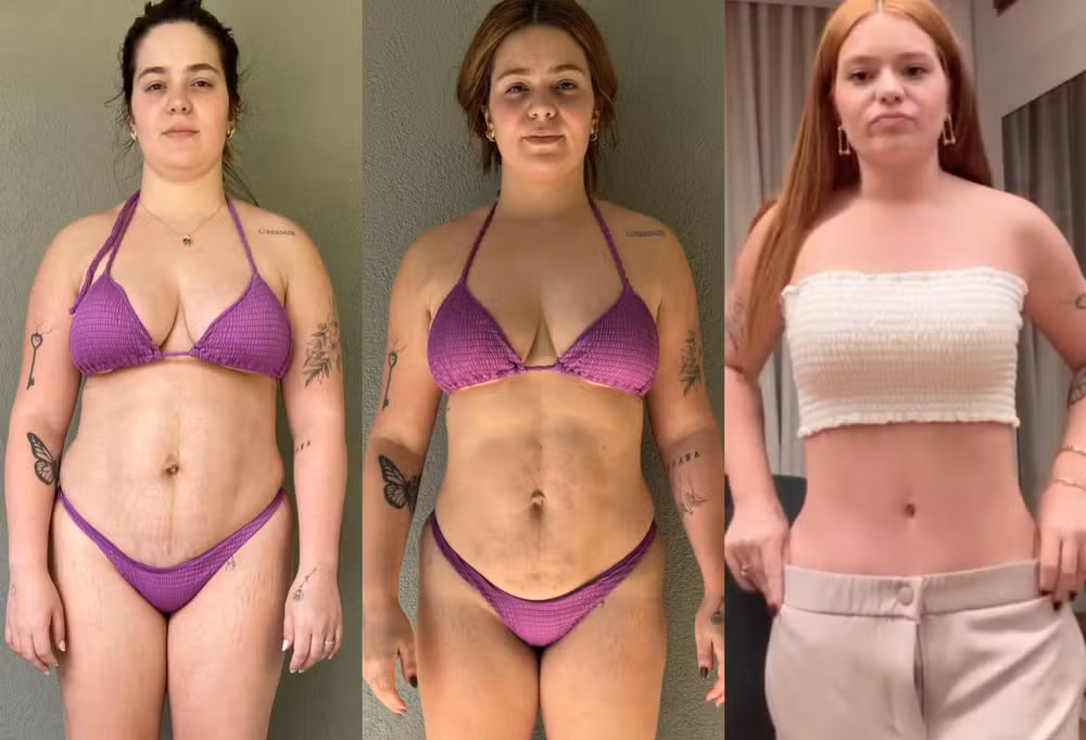 Viih Tube celebra resultados cinco meses após lipo e abdominoplastia e mostra transformação corporal 9 Viih Tube celebra resultados cinco meses após lipo e abdominoplastia e mostra transformação corporal - Foto: instagram