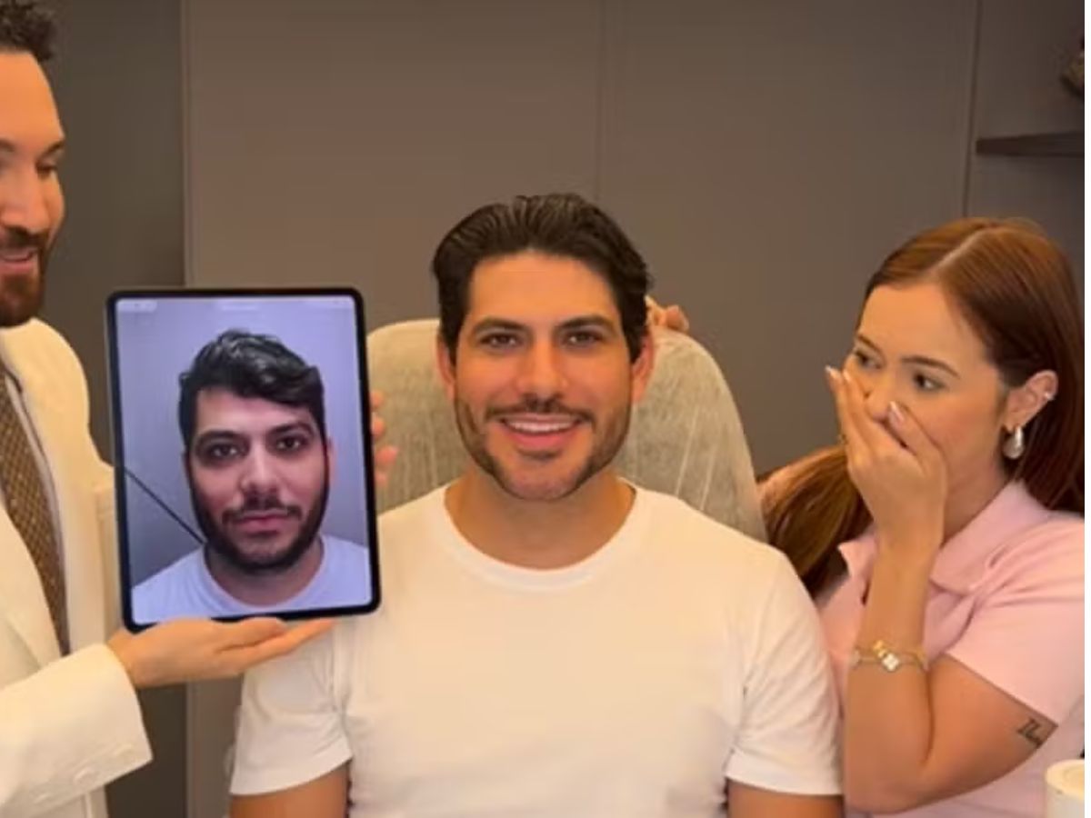 Mirela Janis exibe harmonização facial de Yugnir Ângelo e casal diverte web com vídeo de antes e depois - Foto: instagram