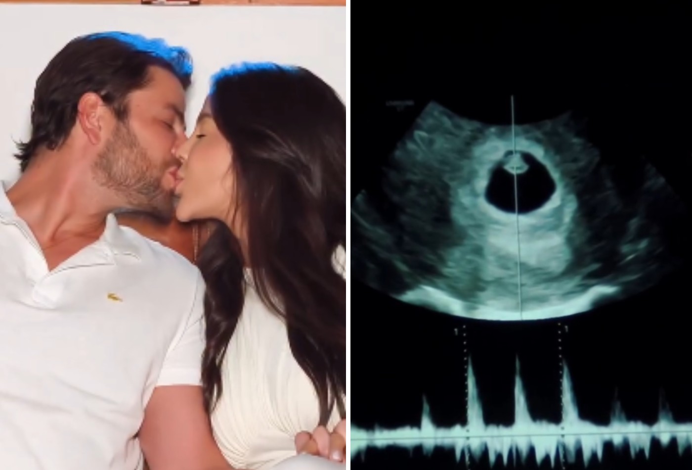 Laís Caldas e Gustavo Marsengo anunciam gravidez do primeiro filho após casamento