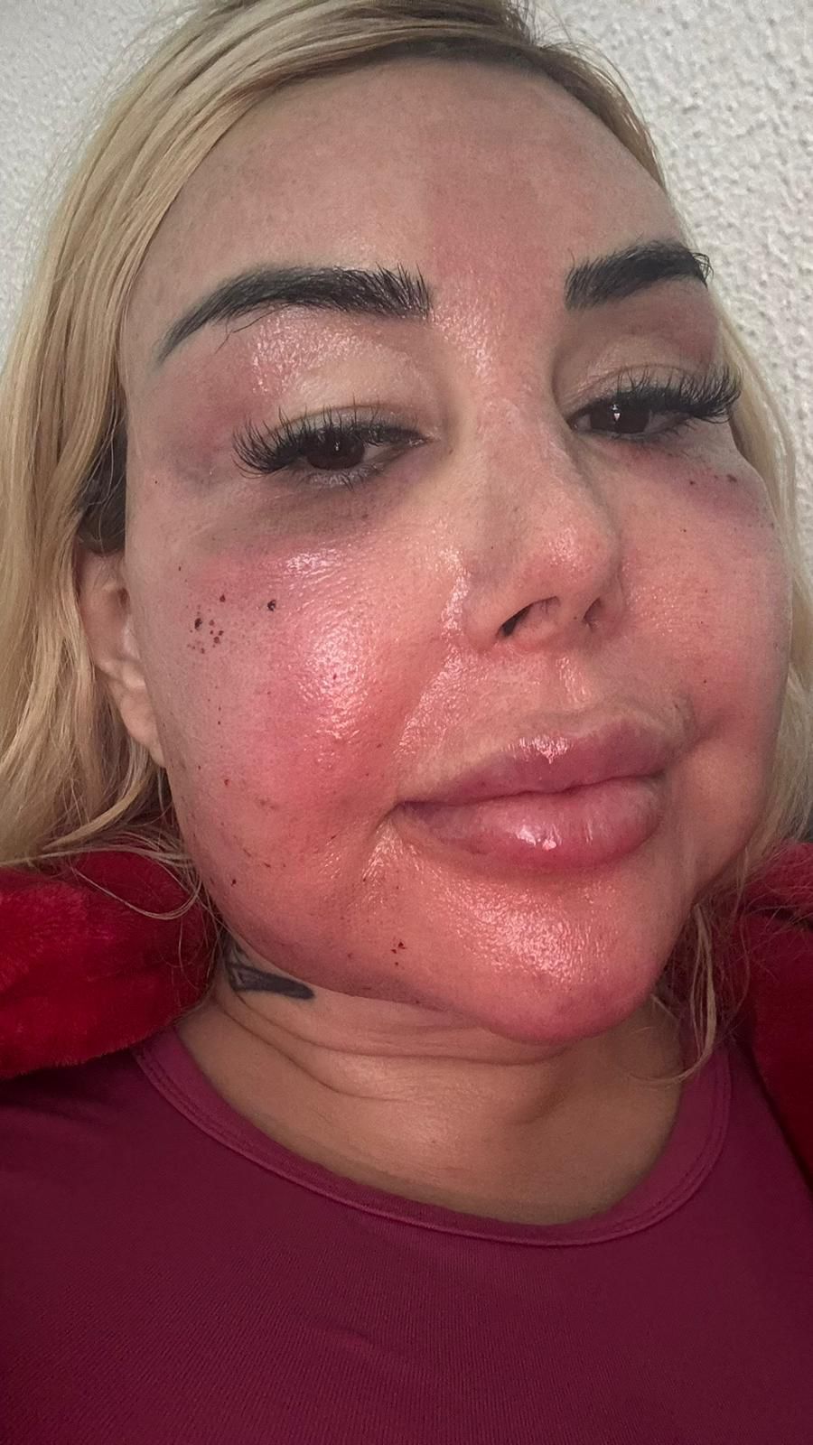 Patrícia Ribeiro se sujeita a nova intervenção cirúrgica após deformações no rosto 6 IMG 20251212 WA0043