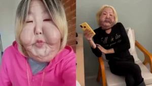 Juju do Pix mostra primeiros avanços após início da reconstrução facial