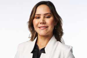 Fios de PDO: Rejuvenescimento Facial Seguro, Natural e Sem Cirurgia