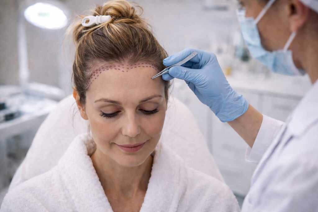 Transplante Capilar Feminino: A Técnica Moderna que Resgata Autoestima e Naturalidade Transplante Capilar Feminino A Tecnica Moderna que Resgata Autoestima e Naturalidade