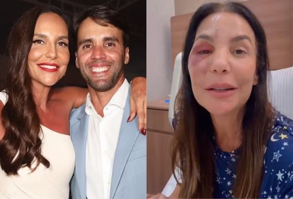 Daniel Cady tranquiliza fãs após cirurgia de Ivete Sangalo: “Foi um susto” Daniel Cady tranquiliza fãs após cirurgia de Ivete Sangalo: “Foi um susto” - Foto: Instagram