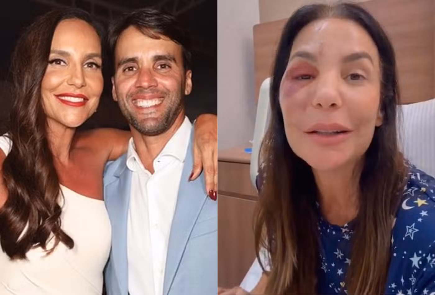 Daniel Cady tranquiliza fãs após cirurgia de Ivete Sangalo: “Foi um susto” - Foto: Instagram