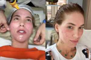 Virginia Fonseca esclarece críticas sobre aparência e nega procedimentos recentes