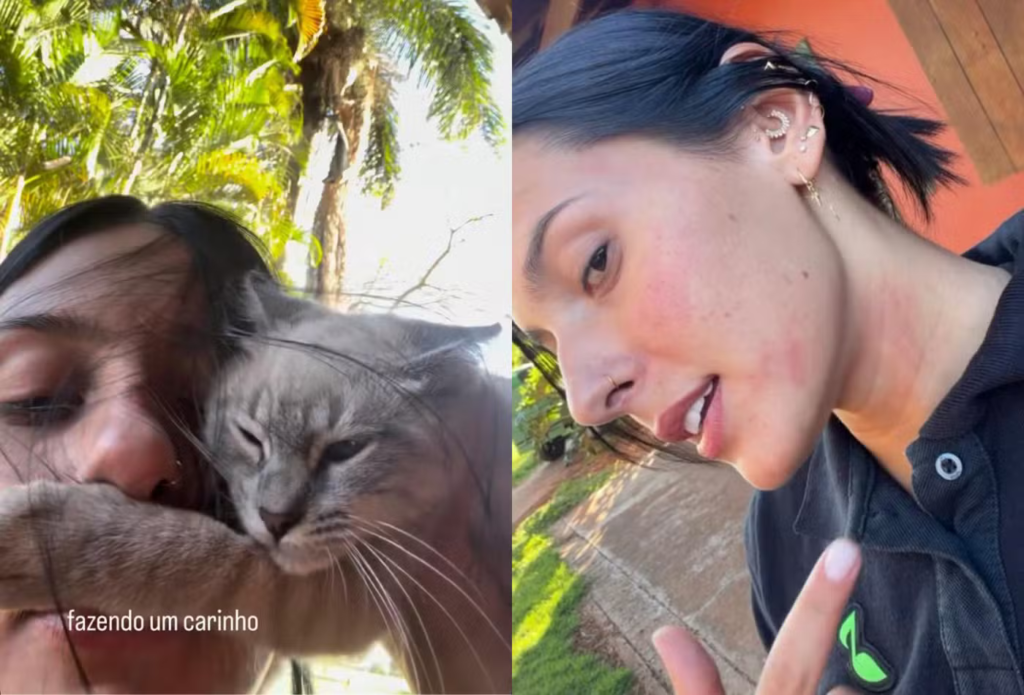 Ana Castela revela alergia a gato e mostra reação após fazer carinho em pet