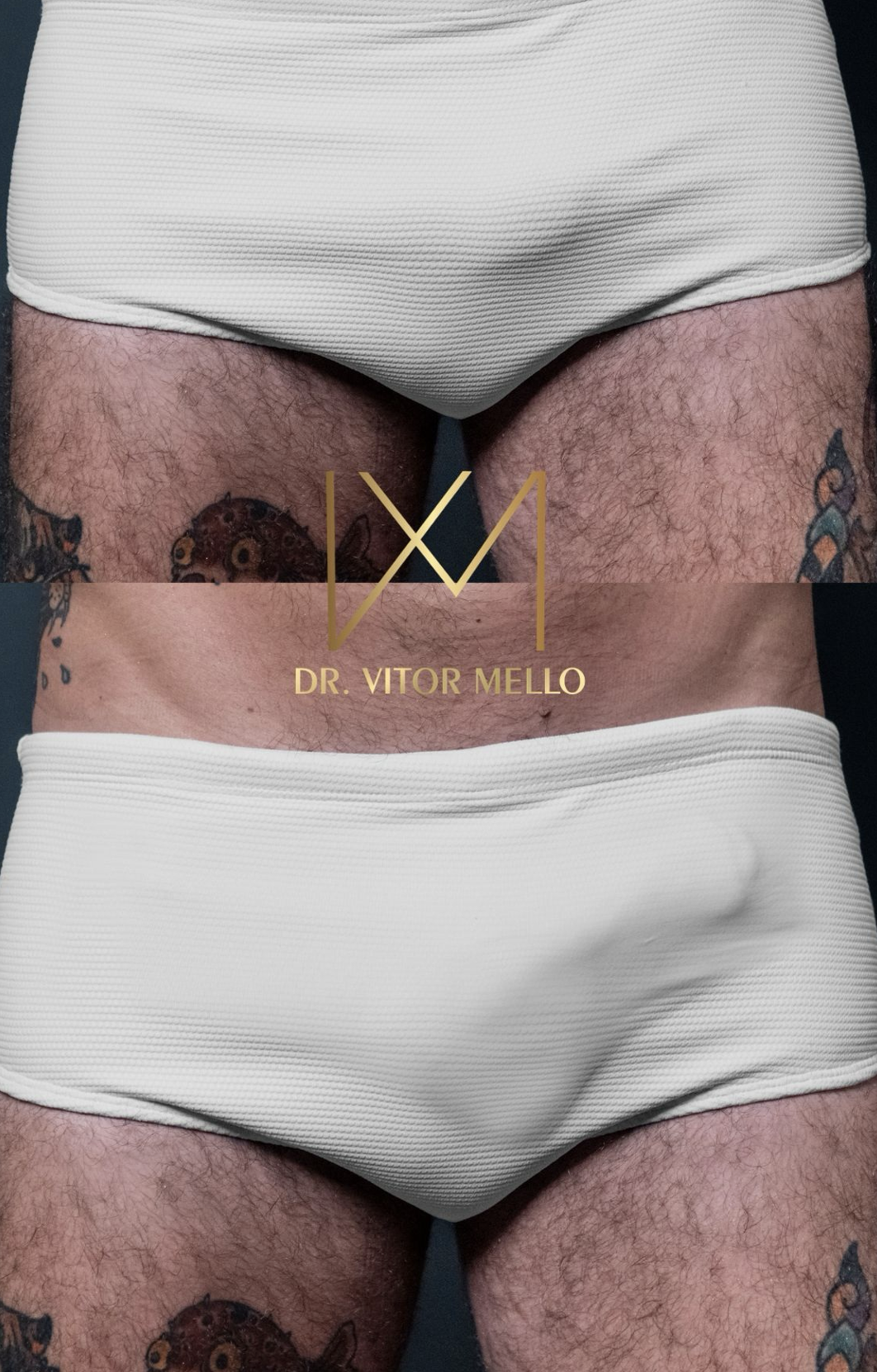 Ex-BBB Wagner Santiago fala sobre nova fase e propósito após retorno à clínica estética 17 Captura de Tela 2026 04 11 as 19.48.32