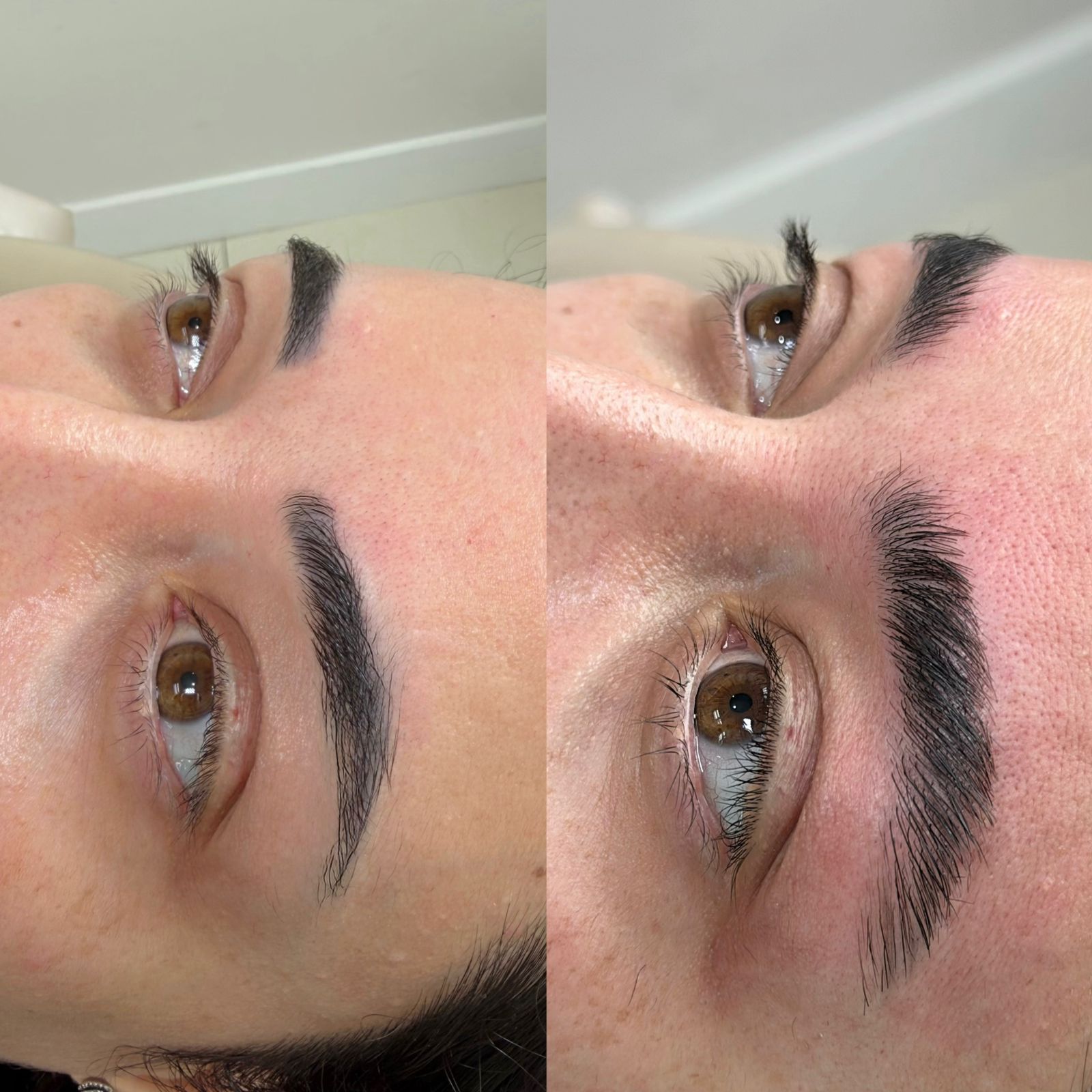 Lucy Toum explica por que regeneração de sobrancelhas ganha espaço entre pacientes 12 IMG 0986.JPG