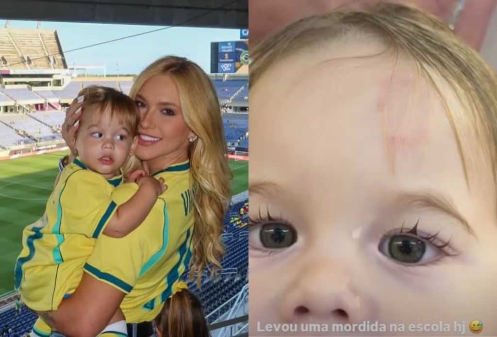 Virginia Fonseca mostra que José Leonardo levou mordida na testa na escola