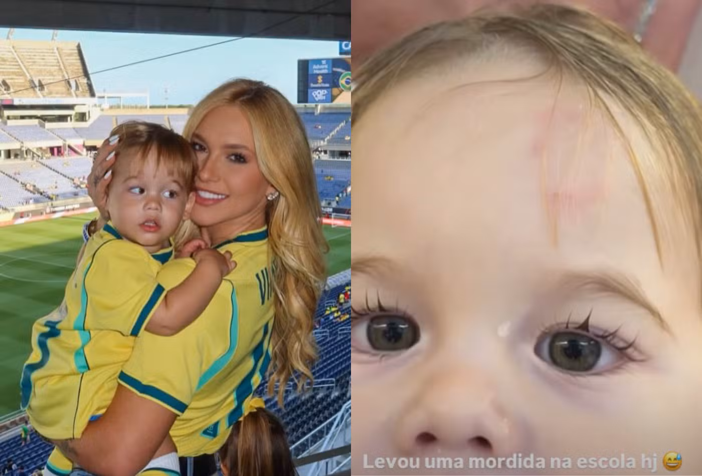 Virginia Fonseca mostra que José Leonardo levou mordida na testa na escola